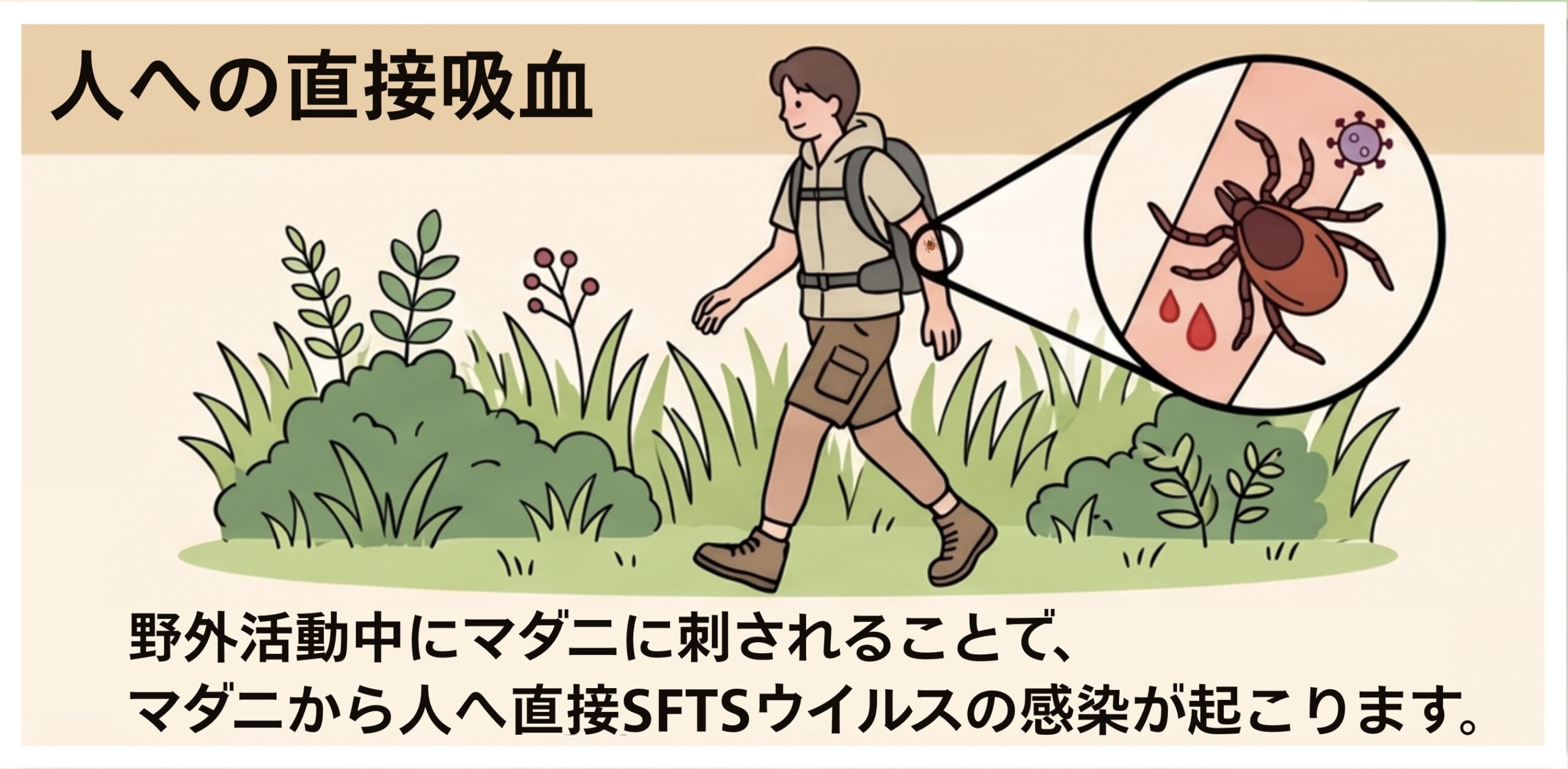 ハイキングや野外活動中にマダニに刺され、人間が直接SFTSウイルスに感染する直接吸血ルートの図
